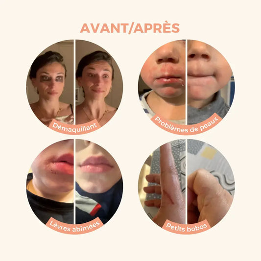 Collage avant-après avec Baume Multi Usage Monoi pour prendre soin de la peau
